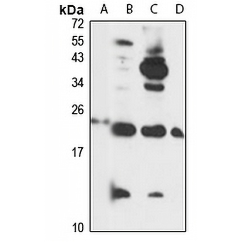 DAD1 Rabbit Polyclonal Antibody