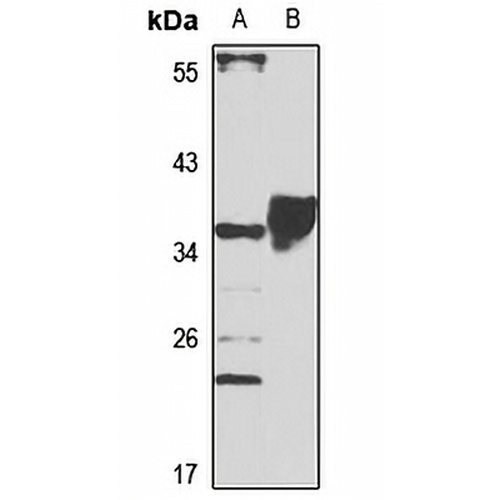 DAZL Rabbit Polyclonal Antibody