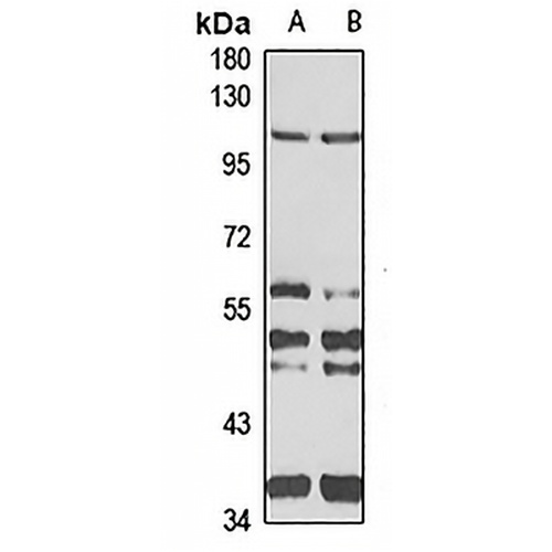 Drebrin Rabbit Polyclonal Antibody