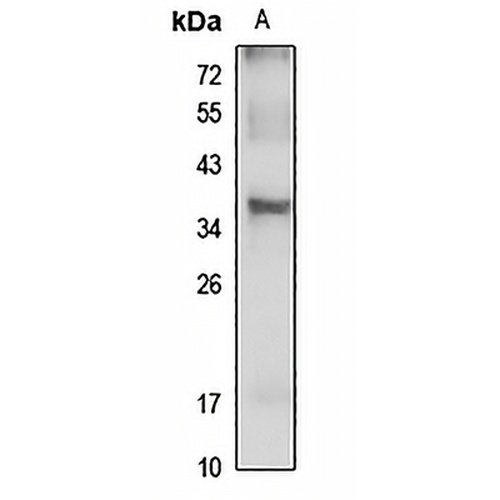 DBP Rabbit Polyclonal Antibody