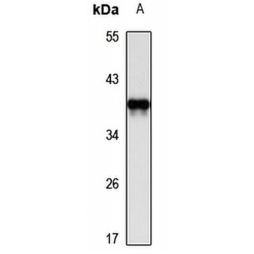 DcpS Rabbit Polyclonal Antibody