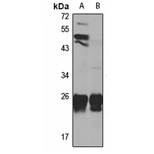 Dynactin 6 Rabbit Polyclonal Antibody