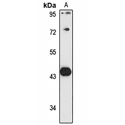 DDI1 Rabbit Polyclonal Antibody