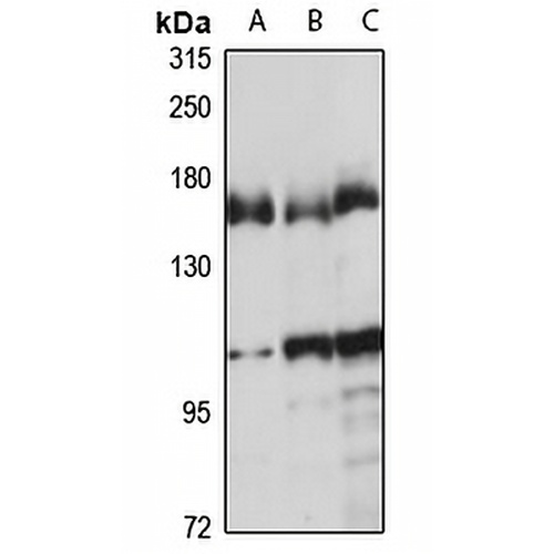 DDX46 Rabbit Polyclonal Antibody