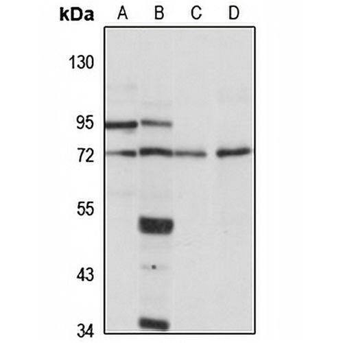 DDX51 Rabbit Polyclonal Antibody