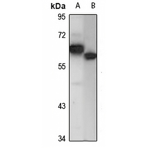 DDX56 Rabbit Polyclonal Antibody