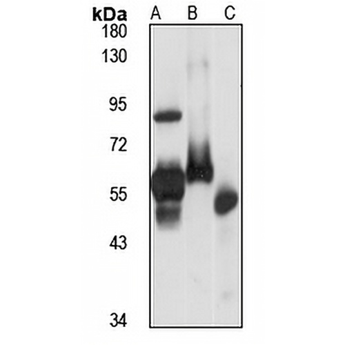 RCK Rabbit Polyclonal Antibody