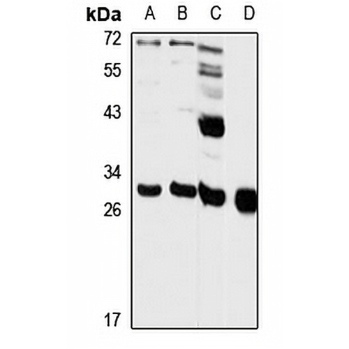 DECR1 Rabbit Polyclonal Antibody