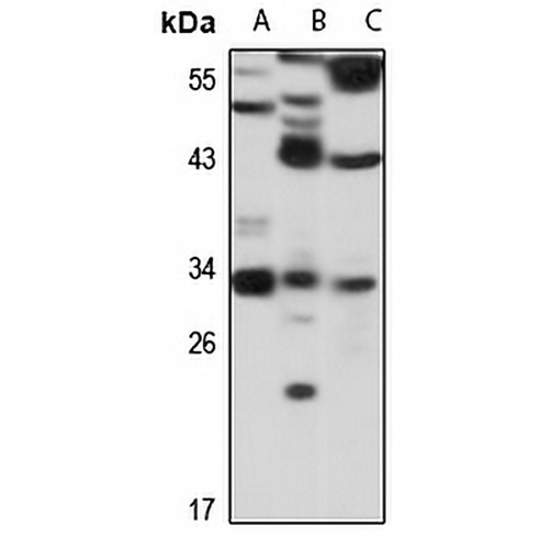 DECR2 Rabbit Polyclonal Antibody