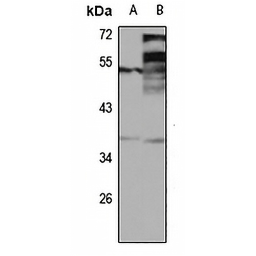 DEDD2 Rabbit Polyclonal Antibody
