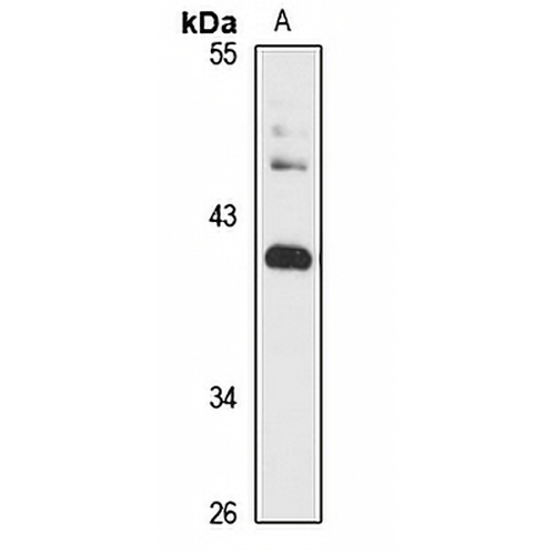 DEGS1 Rabbit Polyclonal Antibody