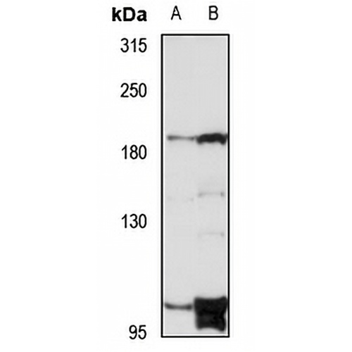DENND4A Rabbit Polyclonal Antibody