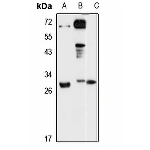 DENR Rabbit Polyclonal Antibody