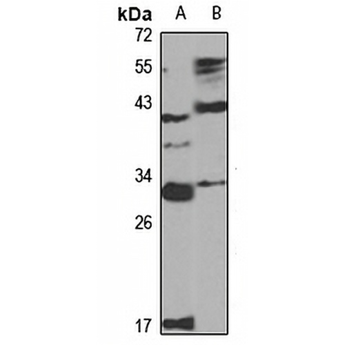 Derlin 1 Rabbit Polyclonal Antibody