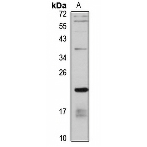 DESI2 Rabbit Polyclonal Antibody