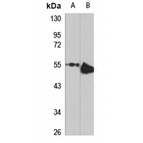 DET1 Rabbit Polyclonal Antibody