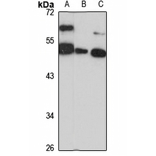 DGCR14 Rabbit Polyclonal Antibody