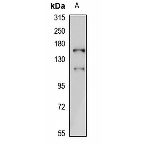 DGK delta Rabbit Polyclonal Antibody