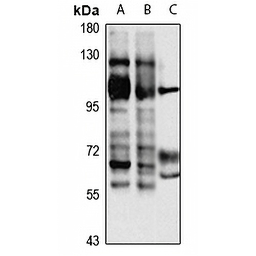 DGK theta Rabbit Polyclonal Antibody
