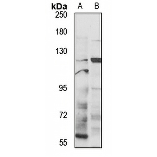 DGK zeta Rabbit Polyclonal Antibody