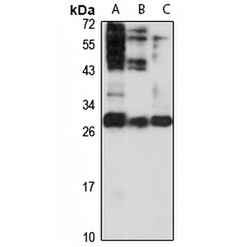 DHDDS Rabbit Polyclonal Antibody