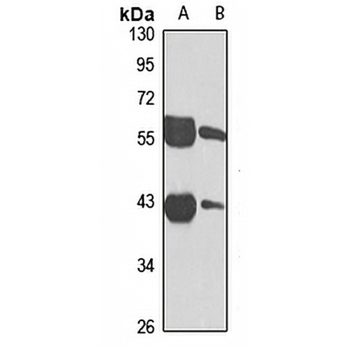 DHDH Rabbit Polyclonal Antibody