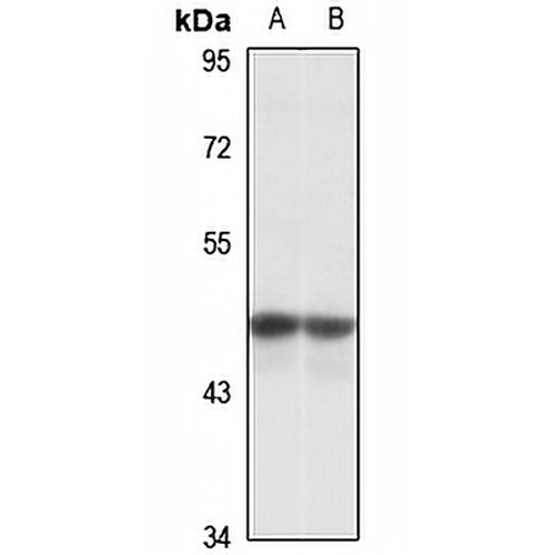 DHH Rabbit Polyclonal Antibody