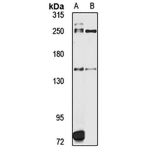 DHX57 Rabbit Polyclonal Antibody