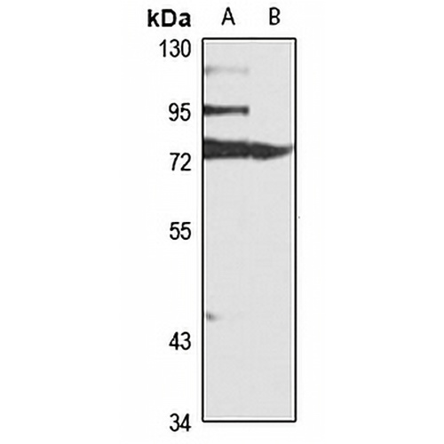 LGP2 Rabbit Polyclonal Antibody