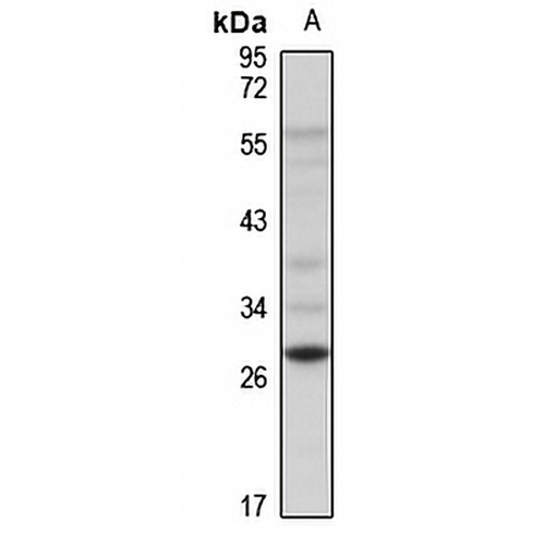 DKK1 Rabbit Polyclonal Antibody