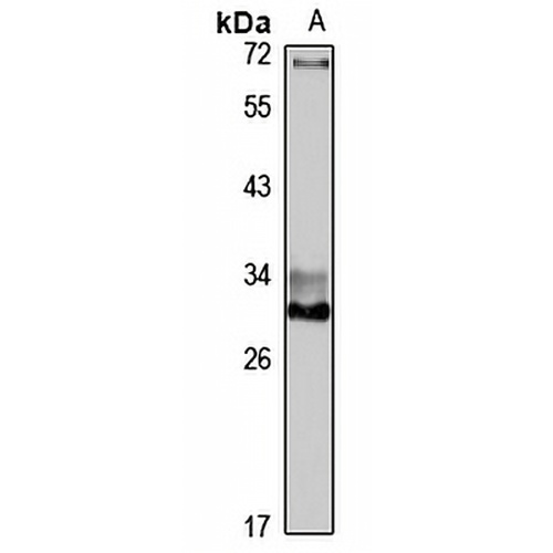 DKK2 Rabbit Polyclonal Antibody