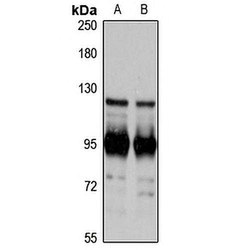 SAPAP2 Rabbit Polyclonal Antibody