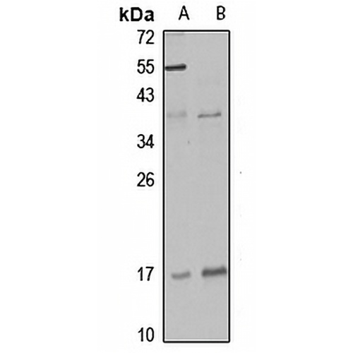 DLX6 Rabbit Polyclonal Antibody