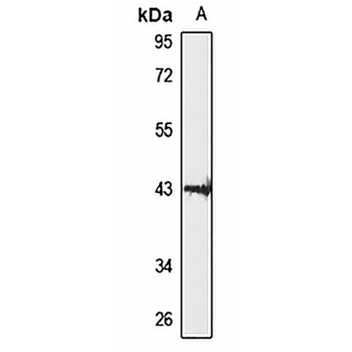 DNAJC18 Rabbit Polyclonal Antibody