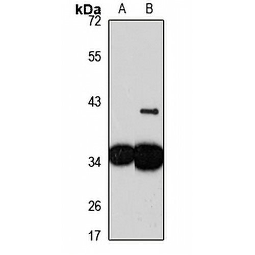 DNAJC9 Rabbit Polyclonal Antibody
