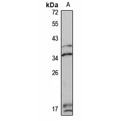 DNASE1L1 Rabbit Polyclonal Antibody