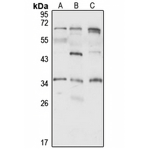 TdTIF1 Rabbit Polyclonal Antibody