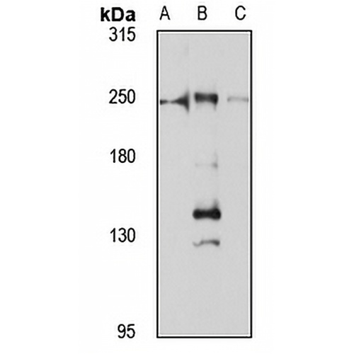 DOCK7 Rabbit Polyclonal Antibody