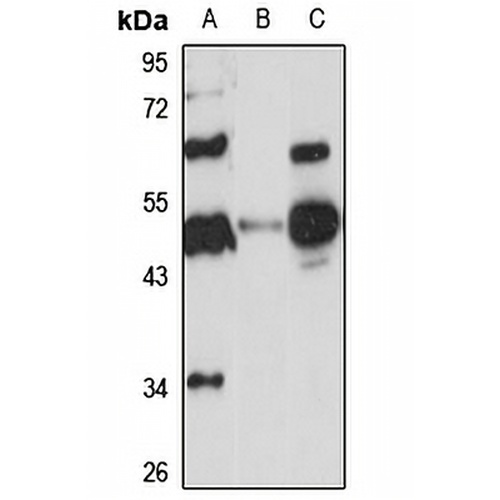DPEP2 Rabbit Polyclonal Antibody