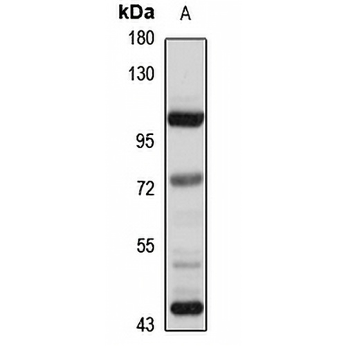 DPP6 Rabbit Polyclonal Antibody