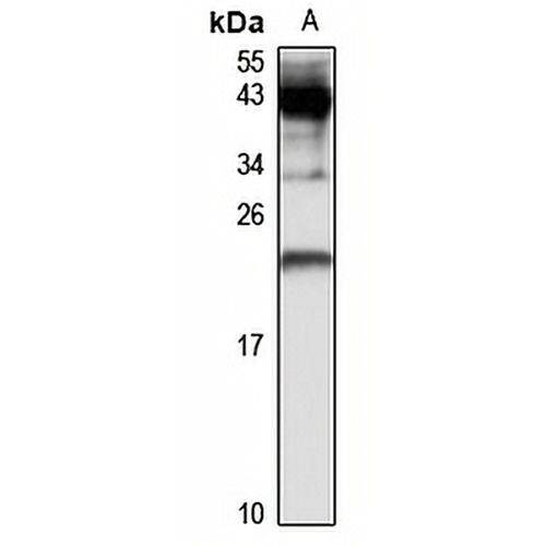 Dermatopontin Rabbit Polyclonal Antibody