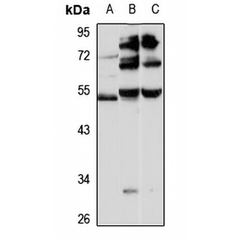 Dopamine Receptor D2 Rabbit Polyclonal Antibody