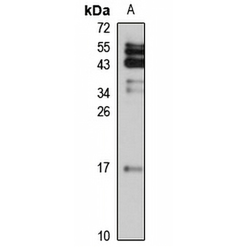 Destrin Rabbit Polyclonal Antibody