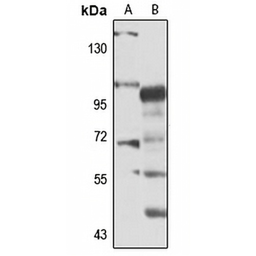 RIP5 Rabbit Polyclonal Antibody