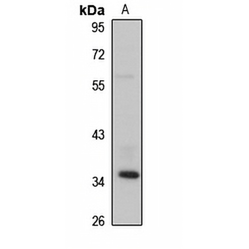 DUSP12 Rabbit Polyclonal Antibody