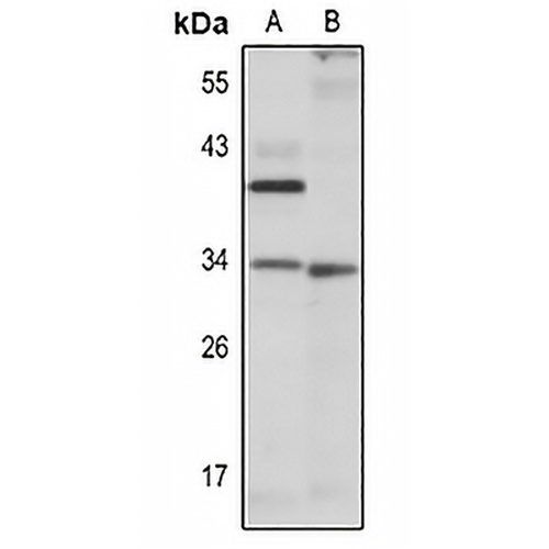 DUSP2 Rabbit Polyclonal Antibody