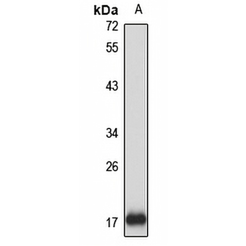 dUTPase Rabbit Polyclonal Antibody