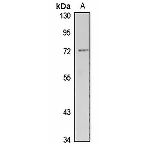 Dymeclin Rabbit Polyclonal Antibody