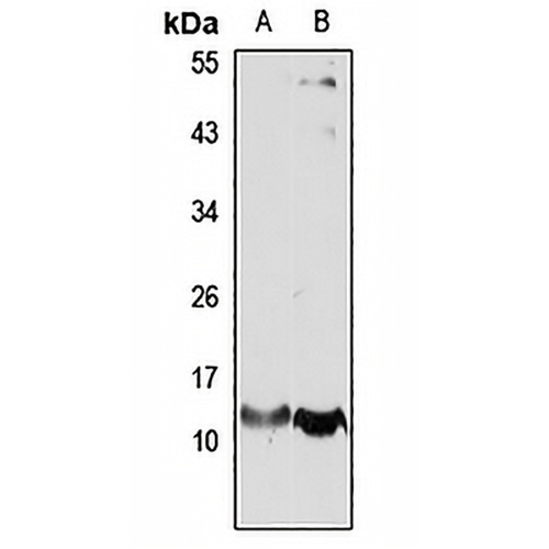 DNLC2A Rabbit Polyclonal Antibody