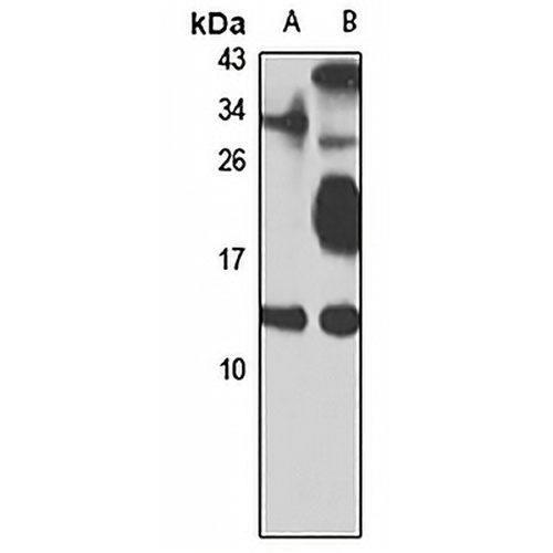 TCTEX-1 Rabbit Polyclonal Antibody